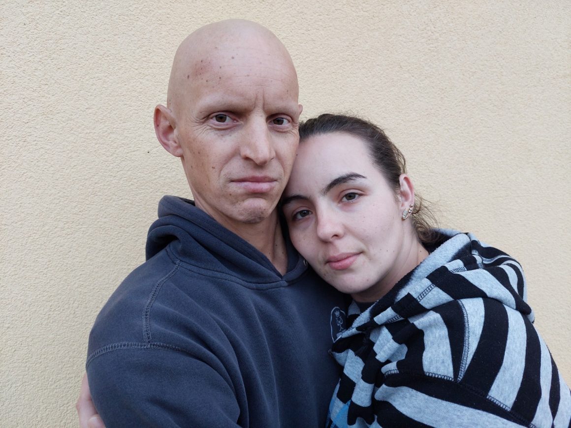 Vasile Sorban 33 ani, cancer